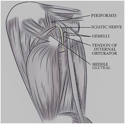 Ultrasonography Findings in the Proximal Sciatic Nerve and Deep Gluteal Muscles in 29 Dogs With Suspected Sciatic Neuritis